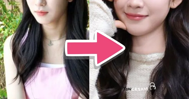ว้าว! Wooyeon จาก WOOAH ถูกกล่าวหาทำศัลยกรรม 😲