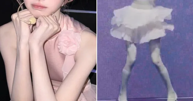 การลดน้ำหนักของไอดอลหญิงวัย 18 ปีในคลิปไวรัลสร้างความกังวลอย่างมาก