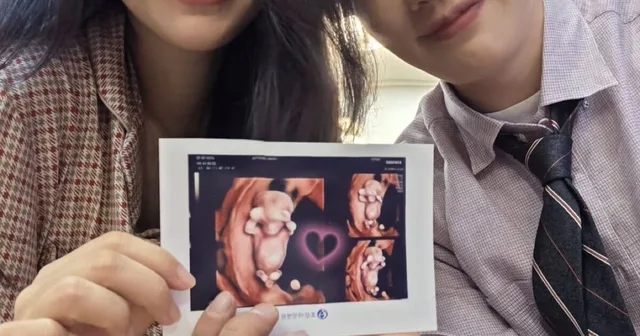 คู่รักคนดังเกาหลีประกาศตั้งครรภ์หลังจากการแท้งและความล้มเหลวในการทำ IVF หลายครั้ง