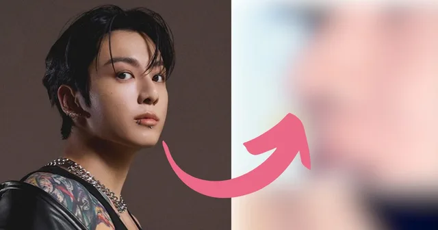 ภาพแผลศัลยกรรมของ Jungkook BTS กลายเป็นไวรัล กระตุ้นปฏิกิริยาที่รุนแรง