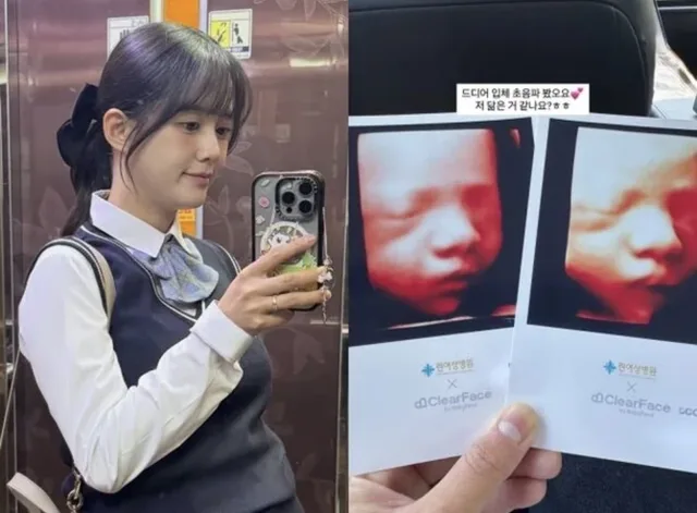 Nam Bo Ra เปิดเผยใบหน้าลูกชายในภาพอัลตราซาวด์ 3D
