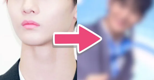 ชาวเน็ตวิจารณ์ไอดอลรุ่นที่ 3 หลังศัลยกรรมทำให้ดูไม่สบายตา