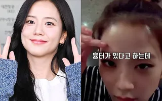 เรื่องราวแผลเป็นวัยเด็กของ Jisoo ถูกนำมาพูดถึงอีกครั้ง ท่ามกลางข้อกล่าวหาทางอาญาต่อพี่ชายของเธอ