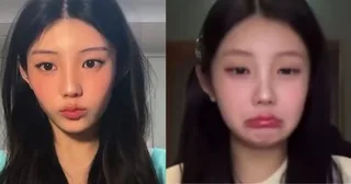 Wonhee วง ILLIT ตอบกลับข่าวลือศัลยกรรมแบบอ้อมๆ! 🤫