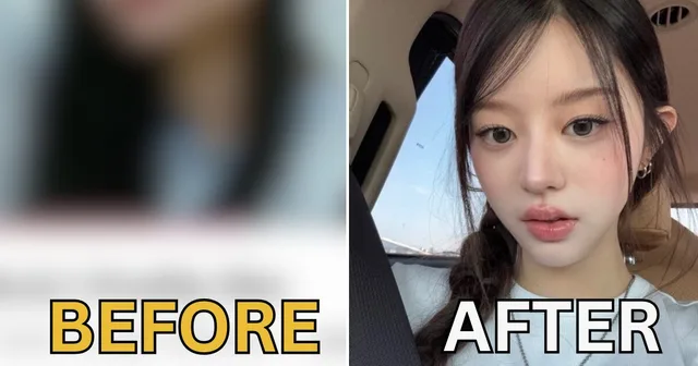 Minju วง ILLIT เจอข่าวลือศัลยกรรมกรามหนักมาก หลังรูปเปรียบเทียบกลายเป็นไวรัล