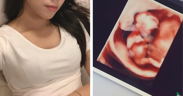 อดีตสมาชิก ABRY Kim Soeun ประกาศข่าวดี ตั้งครรภ์ลูกคนแรกแล้ว!