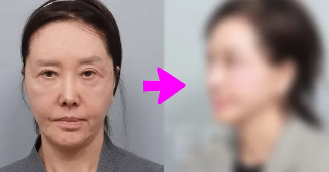 นักแสดงรุ่นใหญ่ Yoo Hye Ri วัย 61 ปี เผยโฉมใหม่หลังศัลยกรรม ทำเอาแฟนๆ ตะลึง!