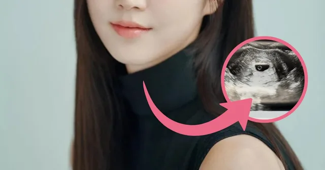 Hong Yookyung เผยตั้งครรภ์แล้ว!