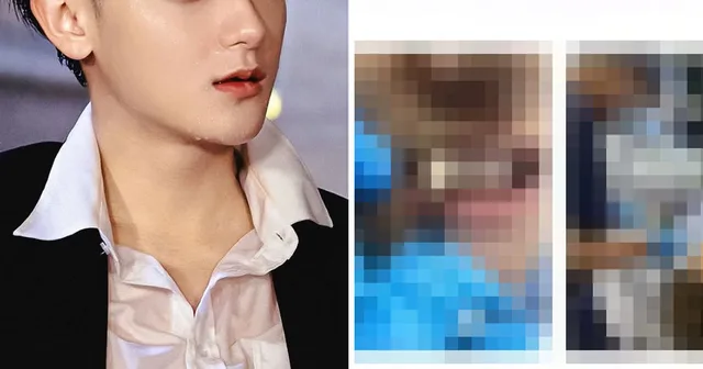 Huang Zitao (Tao) อดีตสมาชิก EXO เดือด! ถูกแอบถ่ายรูปตอนทำฟัน แถมเอาไปโปรโมทคลินิก