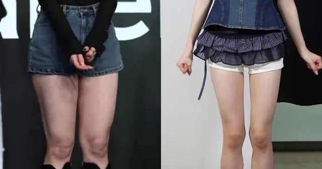 ชาวเน็ตช็อก! STAYC Seeun ผอมลงจนจำแทบไม่ได้