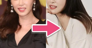 Kang Ye Won นักแสดงสาวเปิดใจ แฟนๆ จำไม่ได้หลังศัลยกรรม