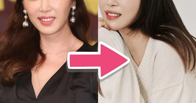 Kang Ye Won นักแสดงสาวเปิดใจ แฟนๆ จำไม่ได้หลังศัลยกรรม