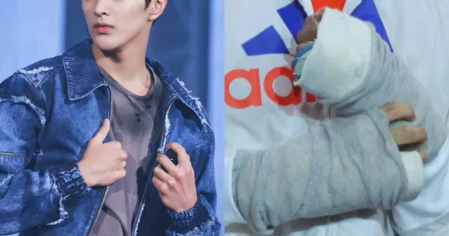 แฟนๆ เป็นห่วง! Keonho วง CORTIS บาดเจ็บมือรุนแรง แต่กลับได้รับการรักษาล่าช้า