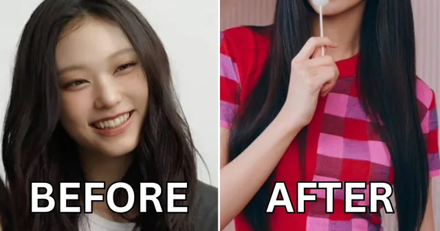 แฟนๆ สังเกตเห็นความเปลี่ยนแปลงในรอยยิ้มของ Haerin วง NewJeans