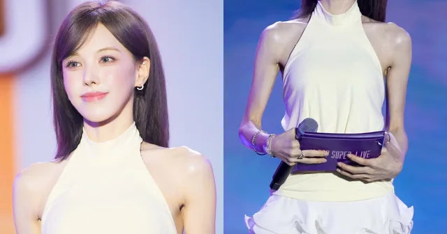 Wendy Red Velvet เผยสาเหตุที่ผอมลงจนแฟนๆ เป็นห่วง