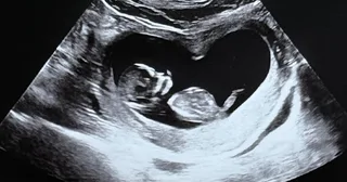Kim Ji Min และ Kim Jun Ho ประกาศข่าวดี ตั้งครรภ์ลูกคนแรก!