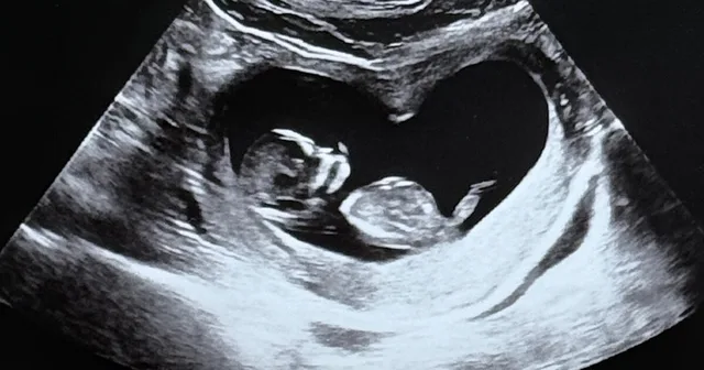 Kim Ji Min และ Kim Jun Ho ประกาศข่าวดี ตั้งครรภ์ลูกคนแรก!