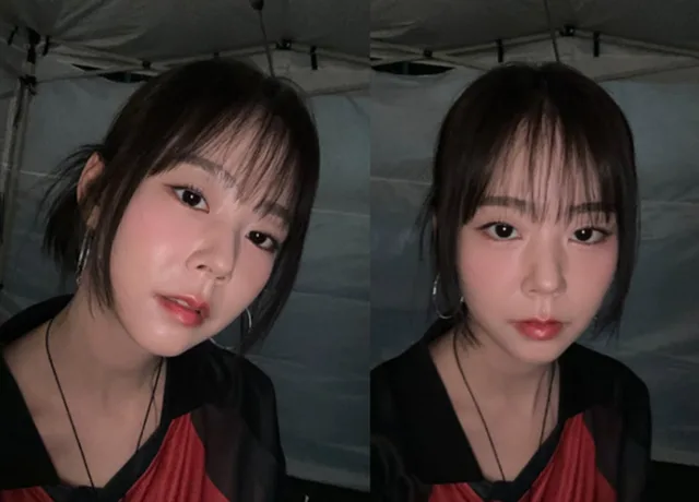 แฟนๆ เป็นห่วง Seungyeon วง KARA หลังขึ้นแสดงทั้งที่ยังรักษาอาการหมอนรองกระดูก
