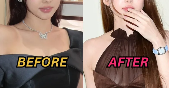 Nayeon วง TWICE เจอชาวเน็ตตั้งข้อสังเกตเรื่องศัลยกรรม หลังปรากฏตัวล่าสุด